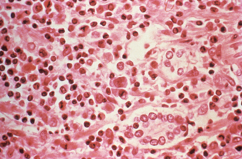 Singapore tests two residents for hantavirus after cruise outbreak