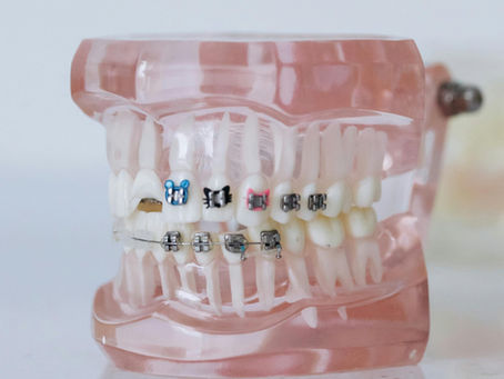 The Orthodontic Connection: Navigating Structural Change with Ease