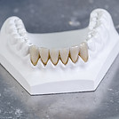 Monolithic zirconia restorations. Teeth in a white cast.jpg