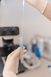 Insemination in der Kinderwunschklinik Graz | FertiliaMed
