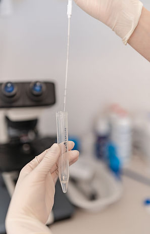 Schwanger werden durch Insemination bei Fertiliamed