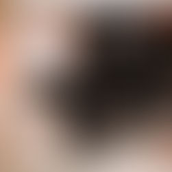 Winterhaut optimal pflegen: Tipps gegen trockene und rissige Haut