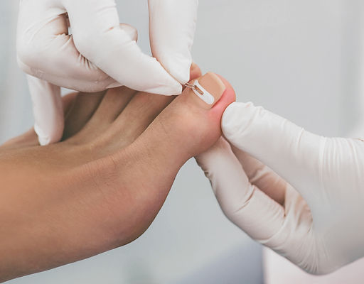 Podologische Fußpflege für Diabetiker in Graz