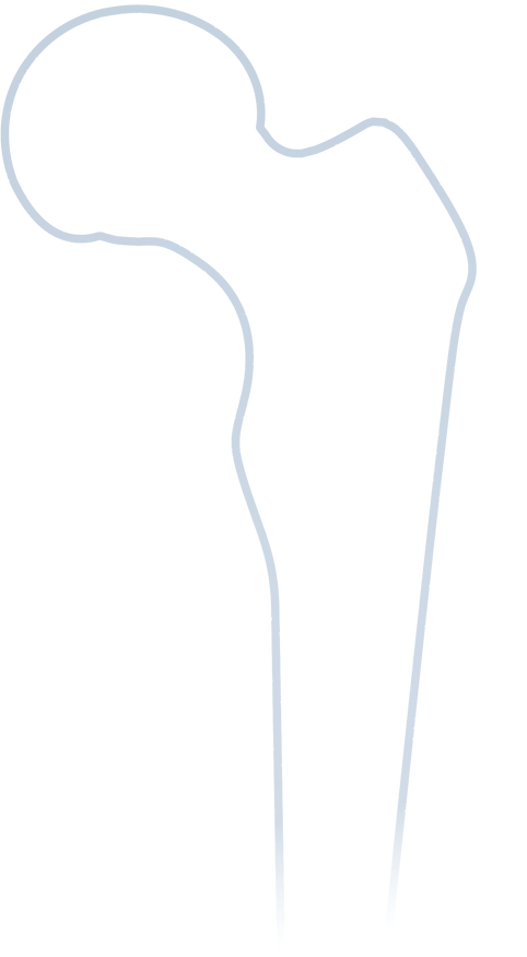 femur_shape_edited.png