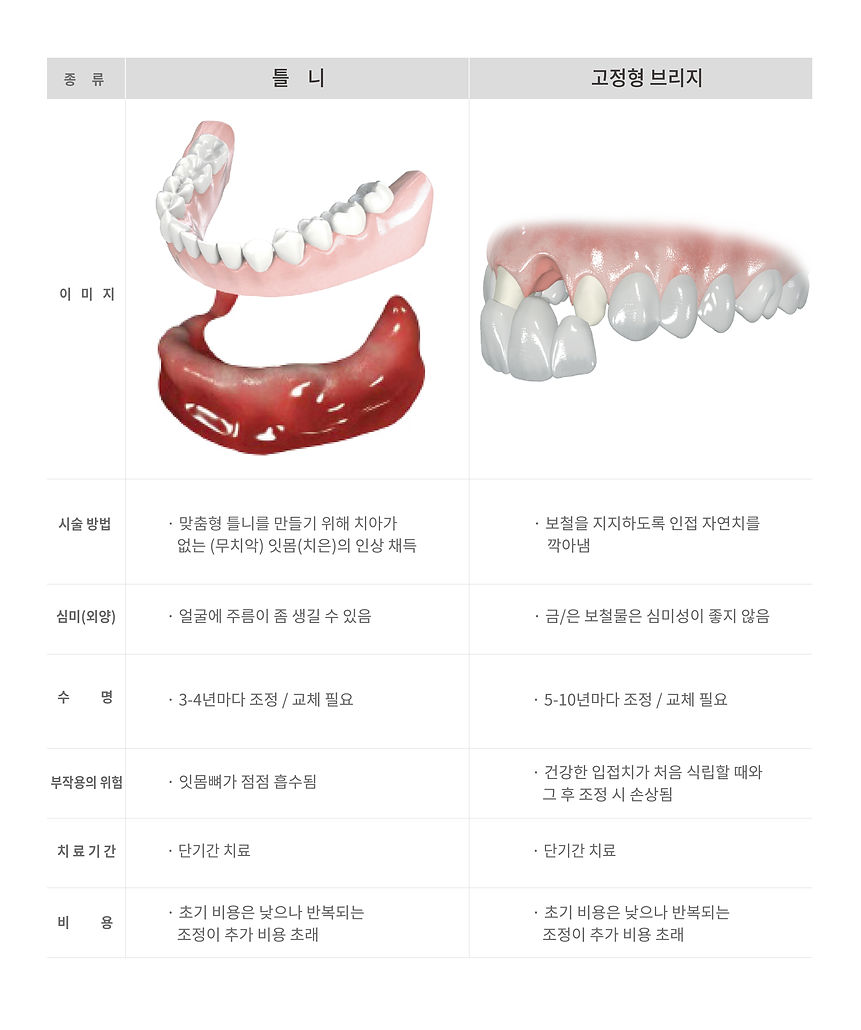 2021 BD_web_임플란트, 오버덴쳐, 브릿지, 틀니-02.jpg