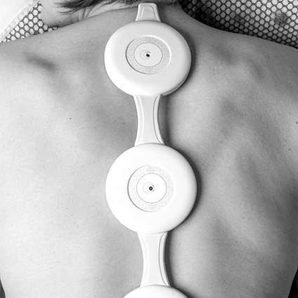 ALMAG-01_Treatment_Back_Spine_B&W.jpg