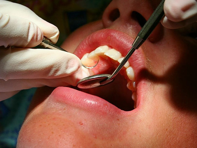 Todays-RDH-Full-Mouth-Debridement.jpeg