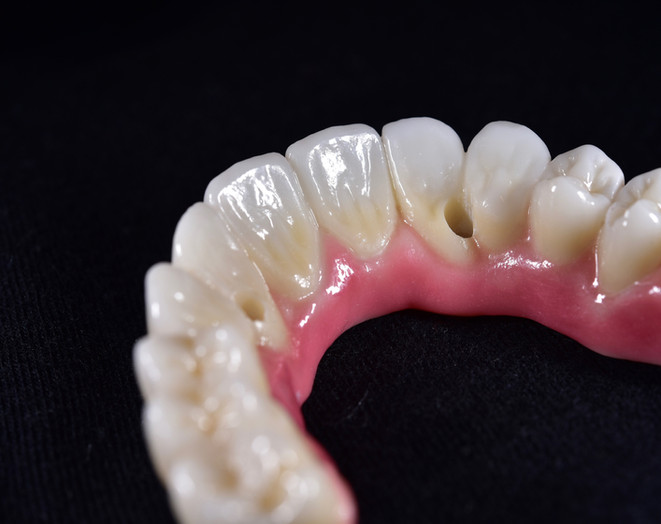 zirconia-hybrid.jpeg