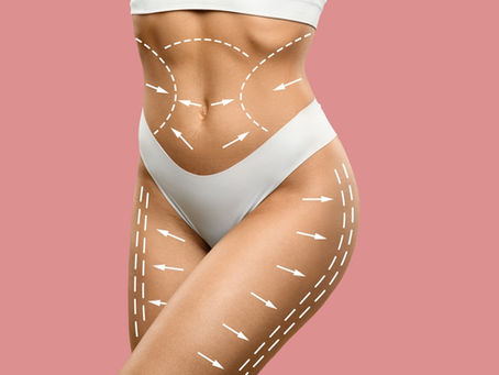 The Art and Science Behind Body Contouring Procedures