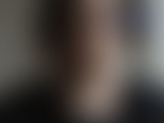 Ses Kısıklığı: Nedenleri, Belirtileri, Tanısı ve Tedavi Seçenekleri