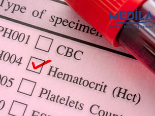 HCT (Hematokrit) Değeri: Ne Anlama Gelir, Neden Yükselir veya Düşer, Nasıl Tedavi Edilir?