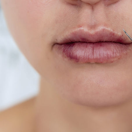 5 Reasons Why Injectables Should Only Be Administered By A Medical Professional