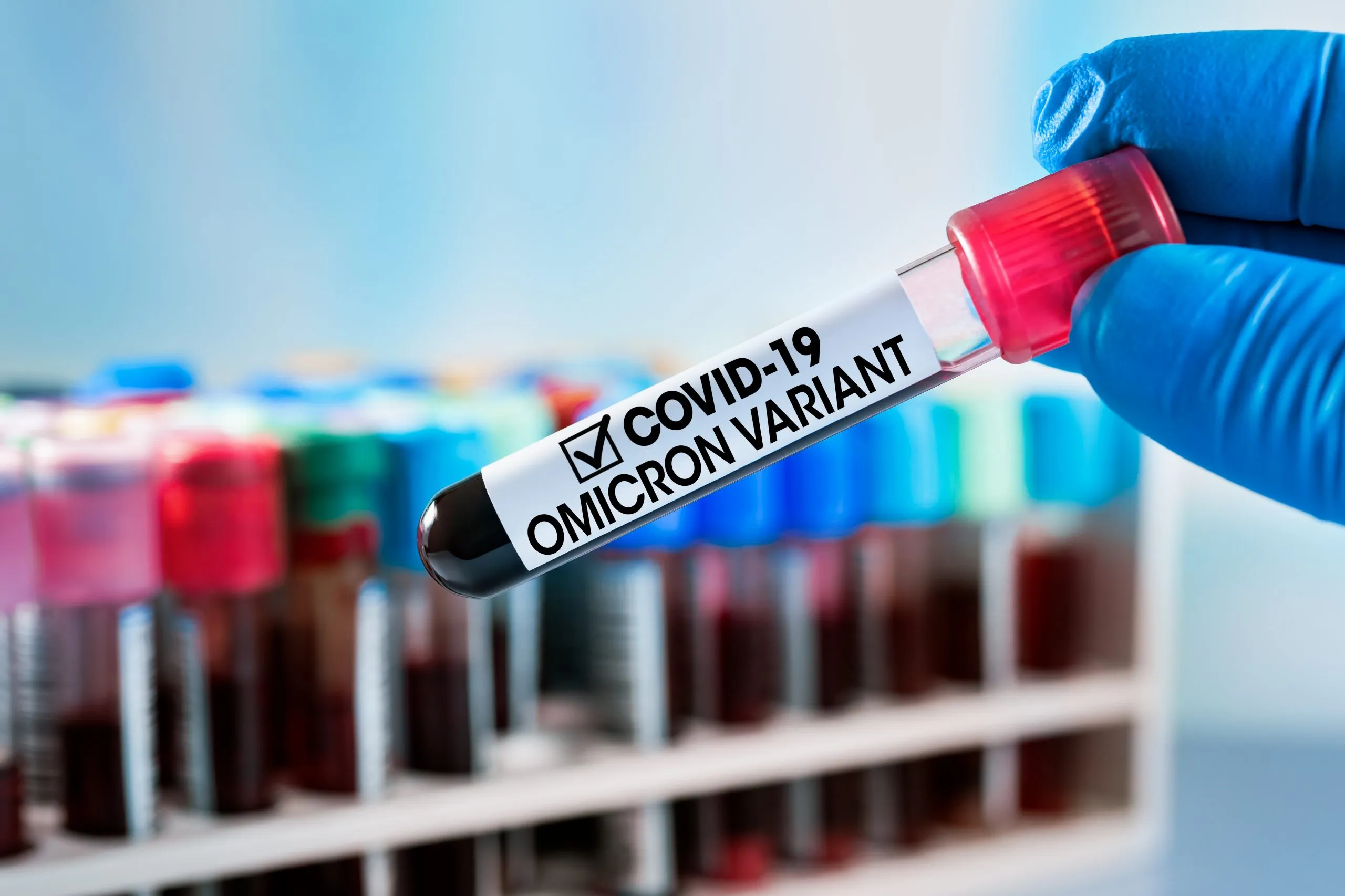 вариант коронавируса Omicron имеет значительно более высокий уровень смертности, чем сезонный грипп