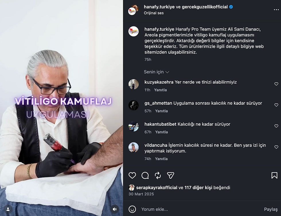 Hanafy Türkiye paylaşımında Ali Sami Danacı'nın vitiligo kamuflaj uygulaması
