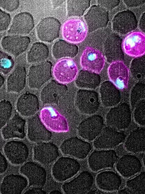 example_image_smear_ifa.jpg