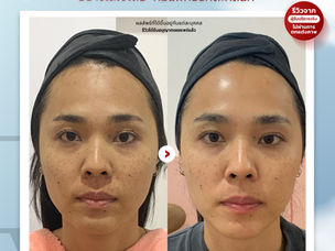 เวลามีคนทักว่า..."ช่วงนี้ดูสดใสขึ้น" มันดีมากนะ | 𝗥𝗲𝘃𝗶𝗲𝘄 โปรแกรม ดูแลผิวและริ้วรอย รักตะคลินิก
