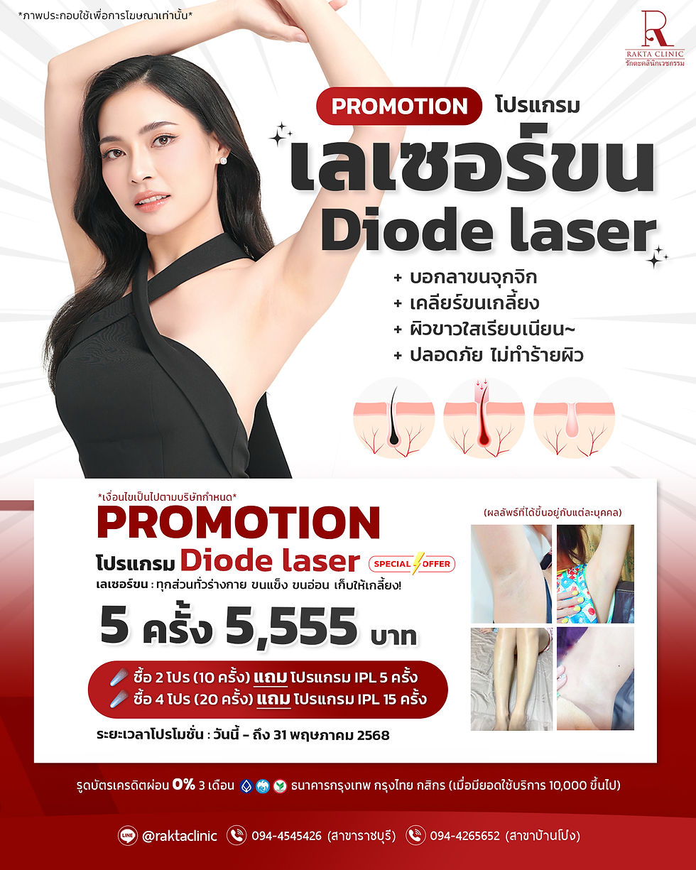 PROMOTION โปรแกรม Diode Laser (เลเซอร์กำจัดขน)