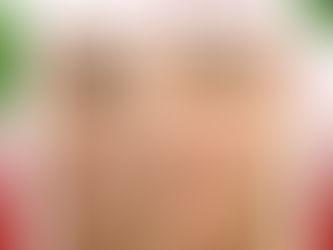 “หลุมสิวเคยลึก…ตอนนี้ตื้นจริง”🧐 ZOOM ดูได้เลยค่ะ 🎄รีวิว🎄(โปรแกรม) รักษาหลุมสิว รักตะคลินิก~