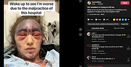 Forçada a tomar 3 vacinas para continuar tratamento, jovem fica cega em minutos e luta pela vida