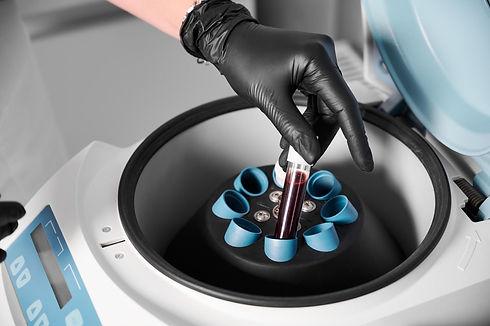 aesthetician-places-prp-tube-in-centrifuge-to-separate-blood-from-plasma-min.jpg