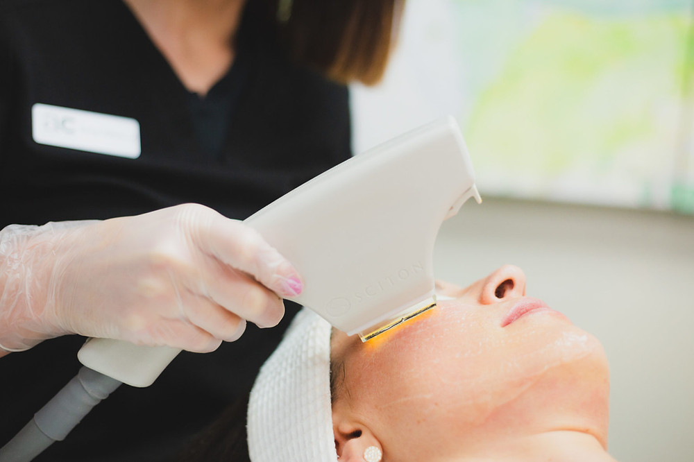 Doctor performing BBL procedure for patient with sun damaged skin