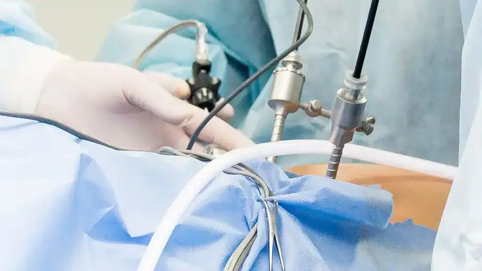 Laparoscopic-Hernia-1024x576