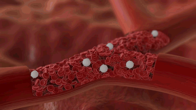 bloodflow2.gif