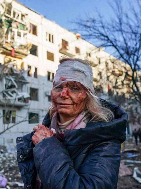 Reportan decenas de muertos en los primeros bombardeos. “La gente está en pánico”, cuentan residente