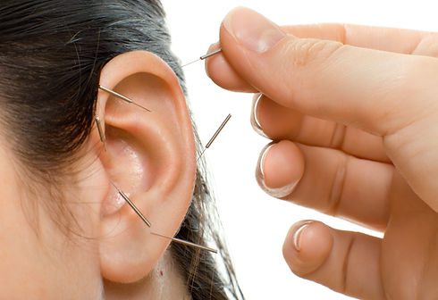 acupuncture therapy on auricle, horizont