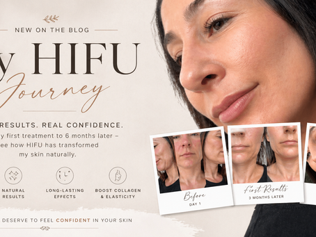 My HIFU Journey: From Structure to Skin Confidence
