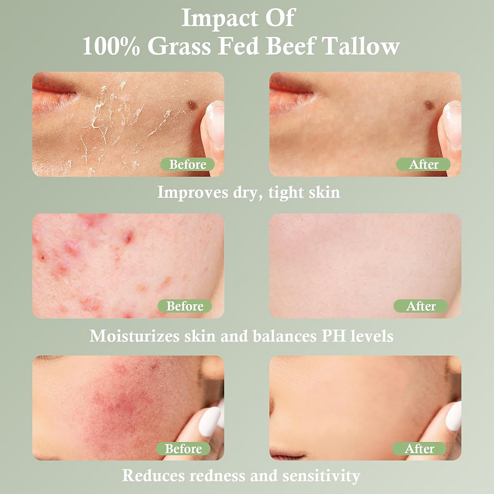 Miniatura: Grass-Fed Tallow Moisturizing Cream – Soothing & Nourishing Skincare
