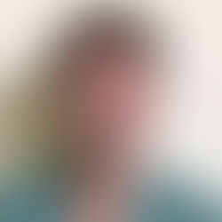 Cosenza, endoprotesi innovativa all’Annunziata