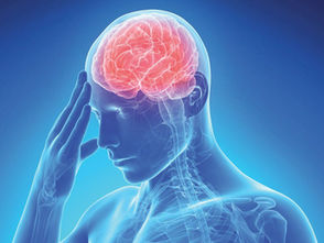 Nuovo dispositivo per prevenire l'ictus