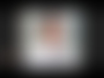 Mieloma multiplo, importante scoperta dell’Umg