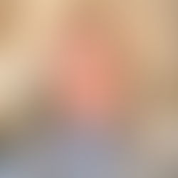 Cure equivalenti, Calabria in coda