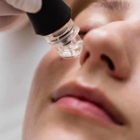 🌿 Hydrafacial : le soin coup d’éclat qui change ta peau