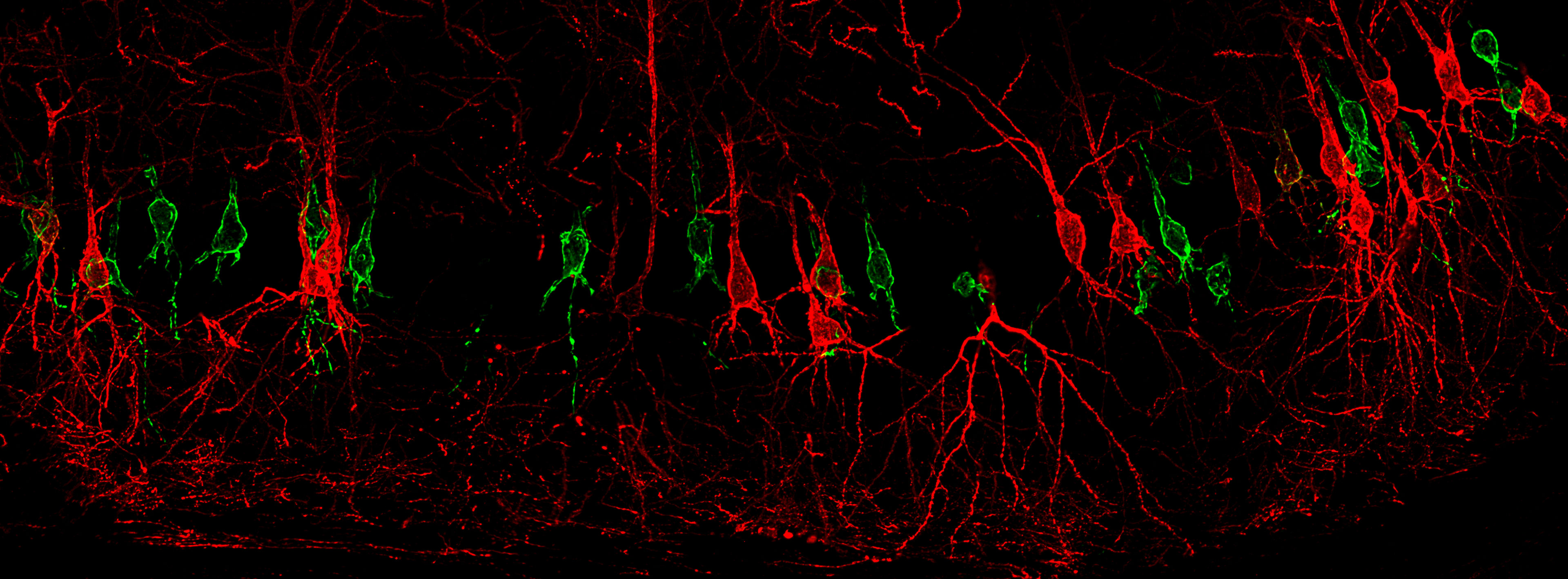 Brain tissue