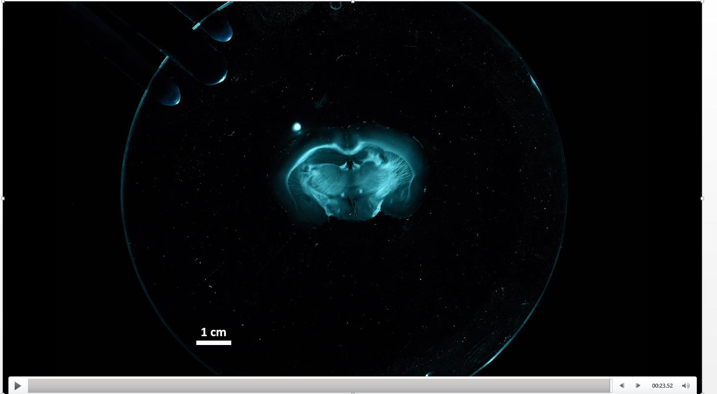 Expansion microscopy