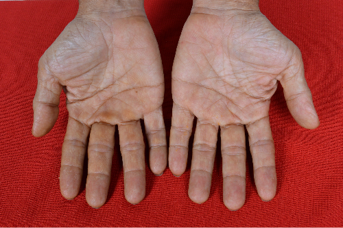 Fate lines in palm,fate lines good and bad points