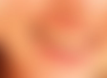 Fatores que deixam os dentes amarelados.