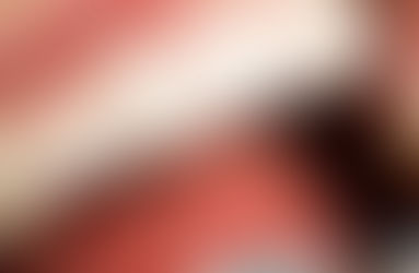 O Que é Periodontite