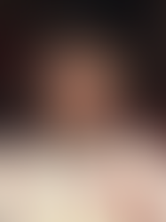 Conor Bradley injury update