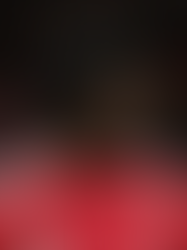 Injury update: Latest on Jeremie Frimpong, Wataru Endo and Joe Gomez