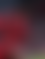 Injury update: Joe Gomez, Dominik Szoboszlai and more