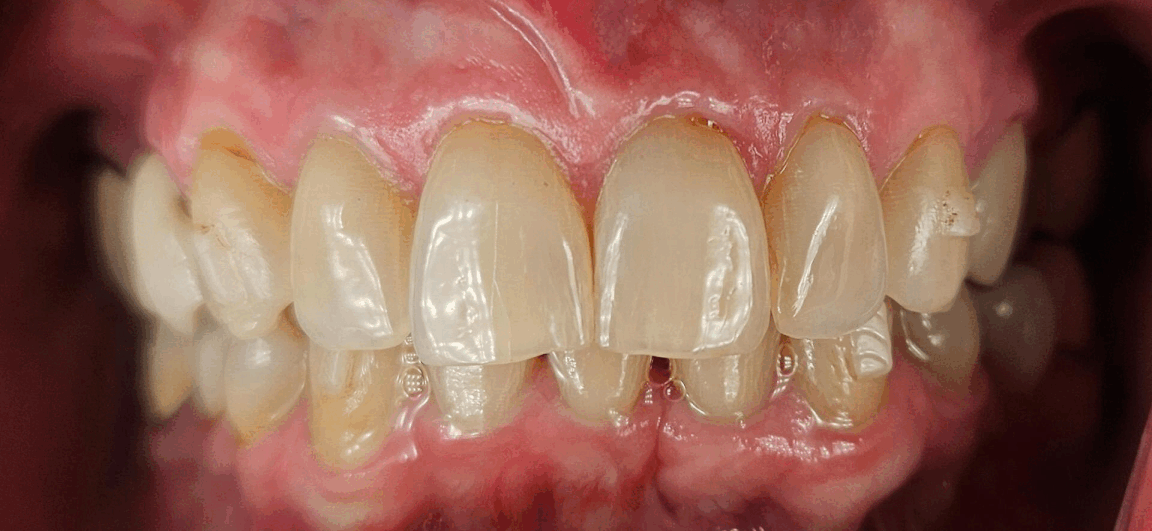 nashua dentist check up