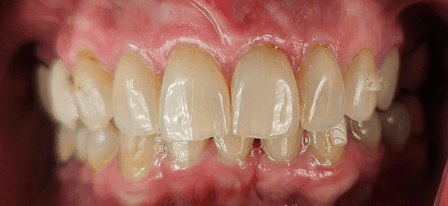 nashua dentist check up