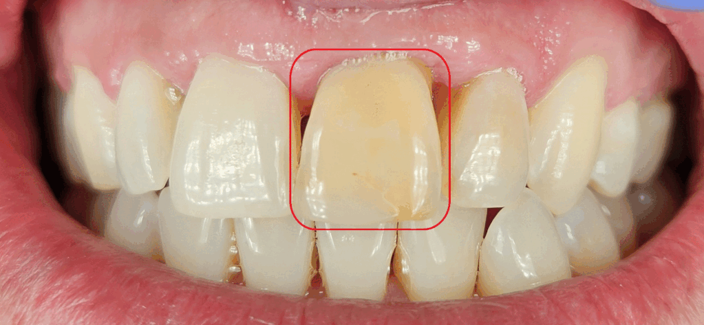 nashua dentist check up