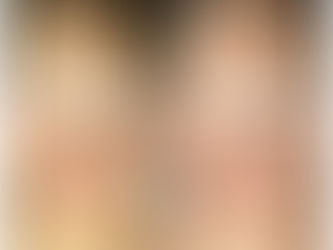 首イボ・首シワ・フェイスラインが気になる方へ!15分の近赤外線2回でも美肌へ