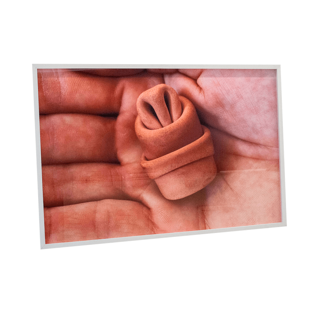 Syringe in the palm of the hand, 1994 - Franklin Cassaro