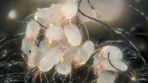 MC Shine Can Help Remove Allergens